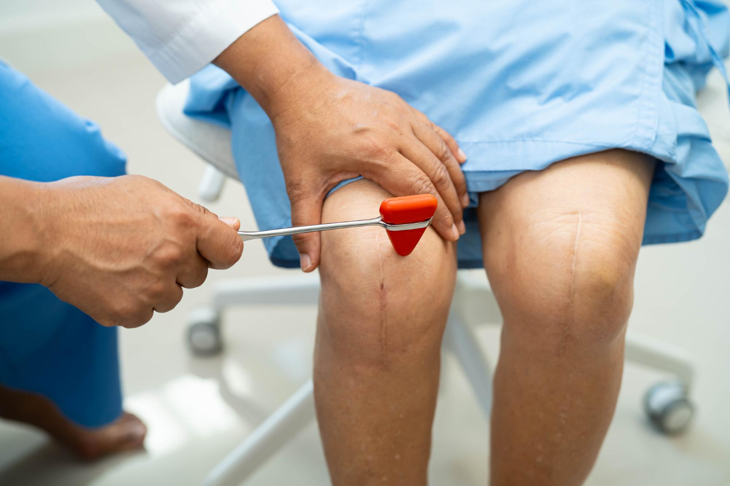 Knee reconstruction
