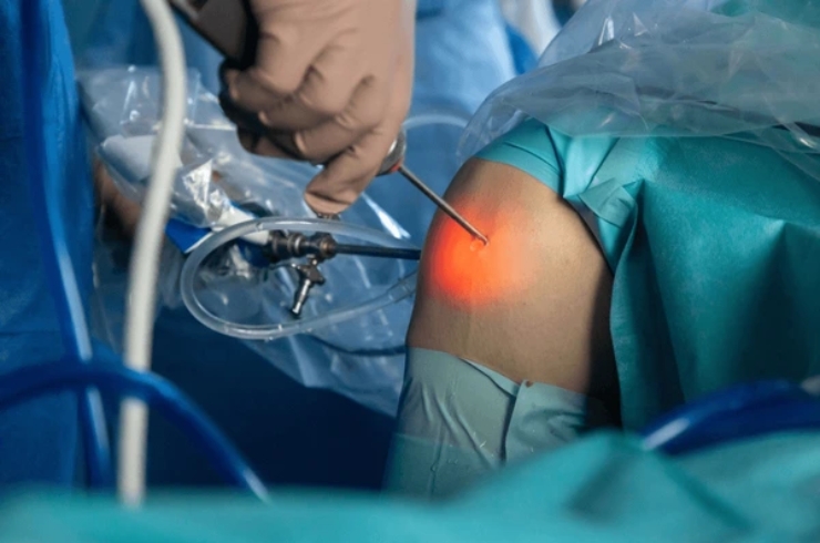 Arthroscopy-15-1